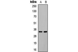 Western blot analysis of C/EBP beta (pT235) expression in HEK293T EGF-treated (A), COLO205 EGF-treated (B) whole cell lysates. (CEBPB Antikörper  (pSer235))