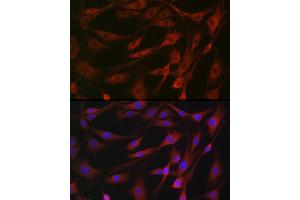 Immunofluorescence analysis of NIH/3T3 cells using MLKL Rabbit pAb (ABIN7268669) at dilution of 1:100 (40x lens). (MLKL Antikörper)