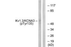 Western blot analysis of extracts from Jurkat cells treated with starved 24h, using Kv1. (KCNA3 Antikörper  (pTyr135))