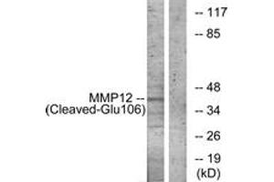 Western blot analysis of extracts from NIH-3T3 cells, treated with etoposide 25uM 1h, using MMP12 (Cleaved-Glu106) Antibody. (MMP12 Antikörper  (Cleaved-Glu106))