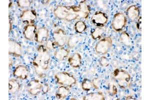 Immunohistochemistry (IHC) image for anti-Cytochrome P450, Family 1, Subfamily A, Polypeptide 1 (CYP1A1) (AA 183-320) antibody (ABIN4950722)