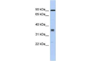 WB Suggested Anti-C6orf154 Antibody Titration: 0. (C6orf154 Antikörper  (Middle Region))