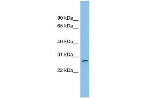 C1orf104 antibody used at 1 ug/ml to detect target protein. (C1orf104 Antikörper  (Middle Region))