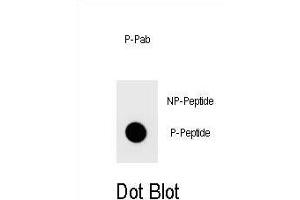 Dot blot analysis of Phospho-TOPBP1- Antibody Phospho-specific Pab (ABIN1539690 and ABIN2839840) on nitrocellulose membrane. (TOPBP1 Antikörper  (pSer1159))