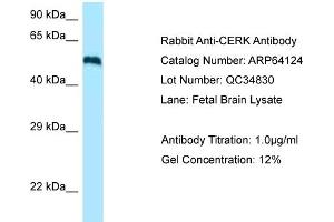 Western Blotting (WB) image for anti-Ceramide Kinase (CERK) (C-Term) antibody (ABIN970379) (CERK Antikörper  (C-Term))
