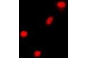 Immunofluorescent analysis of Cbl-3 staining in A549 cells. (CBLC Antikörper)