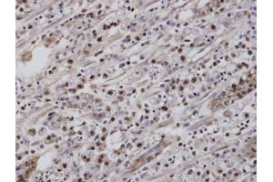 Immunohistochemistry (IHC) image for anti-Nuclear Receptor Subfamily 2, Group F, Member 6 (NR2F6) (C-Term) antibody (ABIN2854676)