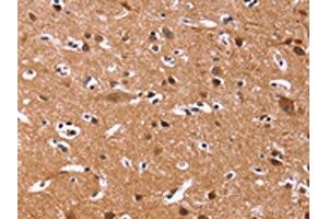 The image on the left is immunohistochemistry of paraffin-embedded Human brain tissue using ABIN7128938(CHRM1 Antibody) at dilution 1/20, on the right is treated with fusion protein. (CHRM1 Antikörper)