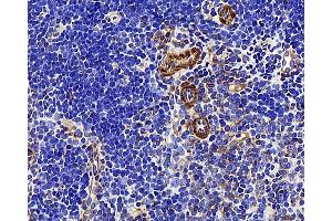 Immunohistochemistry analysis of paraffin-embedded mouse thymus using LDLR Polyclonal Antibody at dilution of 1:300. (LDLR Antikörper)