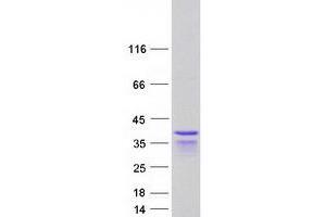 Western Blotting (WB) image for Periphilin 1 (PPHLN1) (Transcript Variant 8) protein (Myc-DYKDDDDK Tag) (ABIN2728687)