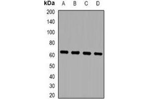 Western blot analysis of ZNF307 expression in MCF7 (A), HepG2 (B), mouse brain (C), mouse lung (D) whole cell lysates. (ZKSCAN4 Antikörper)