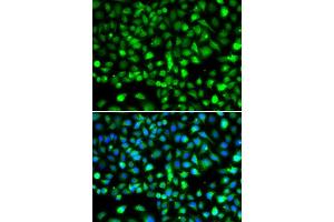 Immunofluorescence analysis of MCF-7 cells using SMYD1 antibody (ABIN6128707, ABIN6148163, ABIN6148165 and ABIN6219496). (SMYD1 Antikörper  (AA 1-350))