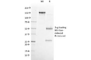 SDS-PAGE Analysis Purified NKX6. (NKX6-1 Antikörper)