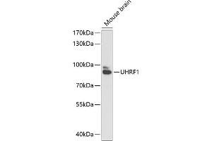 Western blot analysis of extracts of mouse brain, using UHRF1 antibody (ABIN6130753, ABIN6149909, ABIN6149910 and ABIN6216275) at 1:1000 dilution. (UHRF1 Antikörper  (AA 139-298))