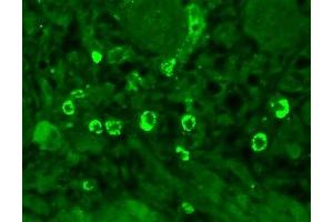Immunohistochemistry analysis using Mouse Anti-GABA A Receptor Monoclonal Antibody, Clone N95/35 (ABIN863139). (GABRA1 Antikörper  (AA 355-394))