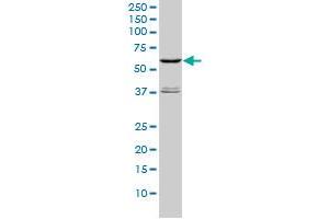 Western Blotting (WB) image for anti-serine/threonine Kinase 4 (STK4) (AA 1-40) antibody (ABIN598949) (STK4 Antikörper  (AA 1-40))