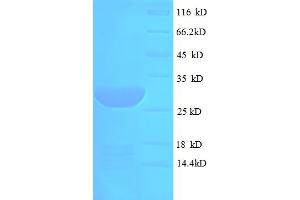 SDS-PAGE (SDS) image for Microfibrillar Associated Protein 5 (MFAP5) (AA 22-173) protein (His-SUMO Tag) (ABIN5711325) (MFAP5 Protein (AA 22-173) (His-SUMO Tag))