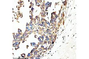 IHC analysis of SPON1 using anti-SPON1 antibody (ABIN7825866).
