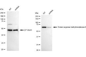 Western blotting analysis using protein arginine methyltransferase 5 antibody (ABIN7799971). (Rekombinanter PRMT5 Antikörper)