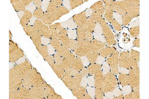 ABIN6256918 and ABIN6275513 at 1/100 staining Rat skin tissue by IHC-P.