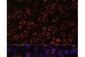 Immunofluorescence analysis of C6 cells using TOM20 Polyclonal Antibody at dilution of 1:100. (TOMM20 Antikörper)