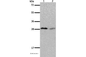 Western blot analysis of Mouse brain and kidney tissue, using KLK7 Polyclonal Antibody at dilution of 1:600 (Kallikrein 7 Antikörper)