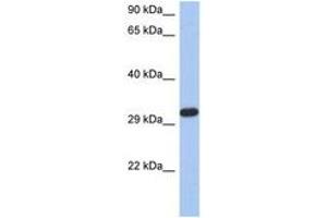 Image no. 1 for anti-Capping Protein (Actin Filament) Muscle Z-Line, alpha 3 (CAPZA3) (N-Term) antibody (ABIN6744292) (CAPZA3 Antikörper  (N-Term))