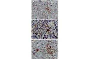 Immunohistochemical analysis of paraffin-embedded human brain tissue (A), lymphoid follicles tissue (B) and interbrain tissue (C), showing cytoplasmic localization.