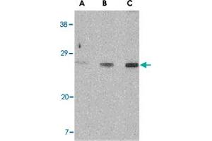 Western blot analysis of XBP1 in PC-3 cell lysate with XBP1 polyclonal antibody  at (A) 0. (XBP1 Antikörper  (C-Term))