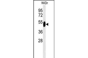 Western blot analysis of SETD6 Antibody (C-term) (ABIN651041 and ABIN2840045) in WiDr cell line lysates (35 μg/lane).