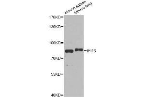 Western blot analysis of extracts of various cell lines, using IFI16 antibody (ABIN6291165) at 1:1000 dilution. (IFI16 Antikörper)