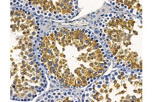 ABIN7096941 and ABIN7101007 at 1/100 staining mouse testis tissue by IHC-P.