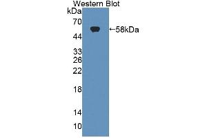Western blot analysis of the recombinant protein. (Tenascin R Antikörper  (AA 329-588))
