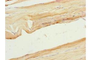 Immunohistochemistry of paraffin-embedded human skeletal muscle tissue using ABIN7175917 at dilution of 1:100 (xpr1 Antikörper  (AA 529-696))