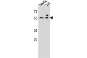 ZFP91 Antibody (Center) (AP54647PU-N ) western blot analysis in HepG2,293 cell line lysates (35 µg/lane). (ZFP91 Antikörper  (Middle Region))
