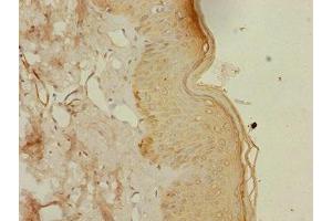 Immunohistochemistry of paraffin-embedded human skin tissue using ABIN7164417 at dilution of 1:100 (DTX2 Antikörper  (AA 1-280))