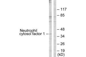 Western blot analysis of extracts from COS7 cells, treated with UV (15mins), using Neutrophil Cytosol Factor 1 (epitope around residue 304) antibody. (NCF1 Antikörper  (Ser304))