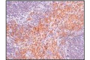 Immunohistochemistry of RIPK1 in mouse kidney tissue with this product at 2. (RIPK1 Antikörper  (N-Term))