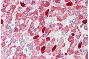 Immunohistochemistry (IHC) image for anti-Cytochrome P450, Family 3, Subfamily A, Polypeptide 4 (CYP3A4) (AA 254-303) antibody (ABIN6754943)