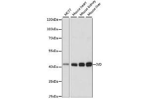 Western blot analysis of extracts of various cell lines, using IVD antibody. (IVD Antikörper)
