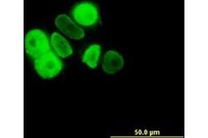 Image no. 2 for anti-Progesterone Receptor (PGR) (AA 1-111) antibody (ABIN598872) (Progesterone Receptor Antikörper  (AA 1-111))