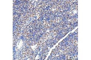 IHC analysis of DDX1 using anti-DDX1 antibody (ABIN7602052).