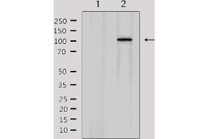 CDCA2 Antikörper  (Internal Region)