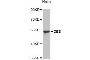 Western blot analysis of extracts of HeLa cells, using DES antibody (ABIN5996882). (Desmin Antikörper)
