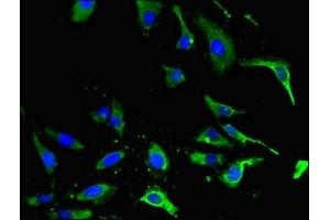 Immunofluorescent analysis of Hela cells using ABIN7151839 at dilution of 1:100 and Alexa Fluor 488-congugated AffiniPure Goat Anti-Rabbit IgG(H+L) (EPH Receptor A4 Antikörper  (AA 345-545))