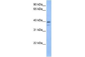 VPS26B antibody used at 1 ug/ml to detect target protein. (VPS26B Antikörper)