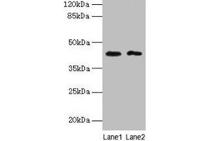 Western blot All lanes: BTBD2 antibody at 6 μg/mL Lane 1: Hela whole cell lysate Lane 2: MDA-MB-231 whole cell lysate Secondary Goat polyclonal to rabbit IgG at 1/10000 dilution Predicted band size: 56, 23 kDa Observed band size: 42 kDa (BTBD2 Antikörper  (AA 321-525))