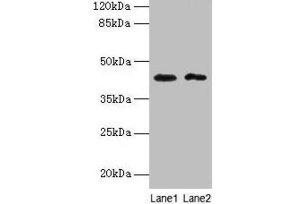 BTBD2 Antikörper  (AA 321-525)