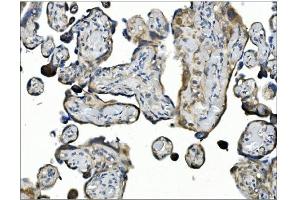 IHC analysis of ANGPT2 using anti-ANGPT2 antibody (ABIN7601450).