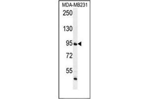 Western blot analysis of FTSJ3 Antibody (Center) in MDA-MB231 cell line lysates (35ug/lane). (FTSJ3 Antikörper  (Middle Region))